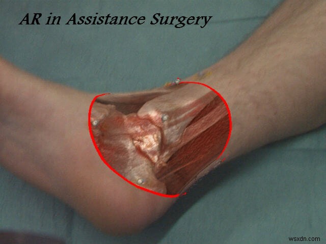 Applications of Augmented Reality in the Field of Medical Sciences –  Part 2